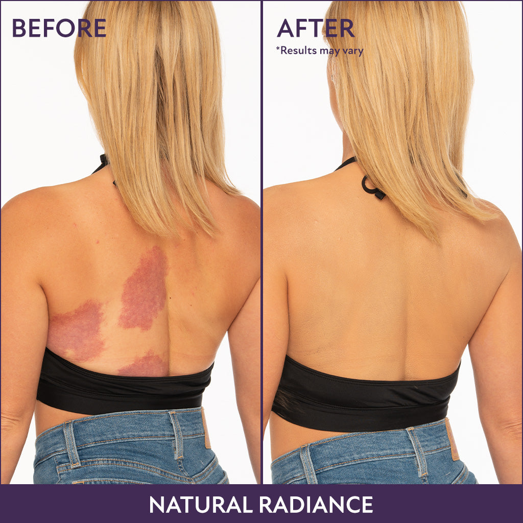 Corrector corporal Perfeccionador